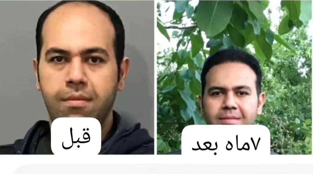 مجموعه کاشت مو و ریش هاتفی در تبریز