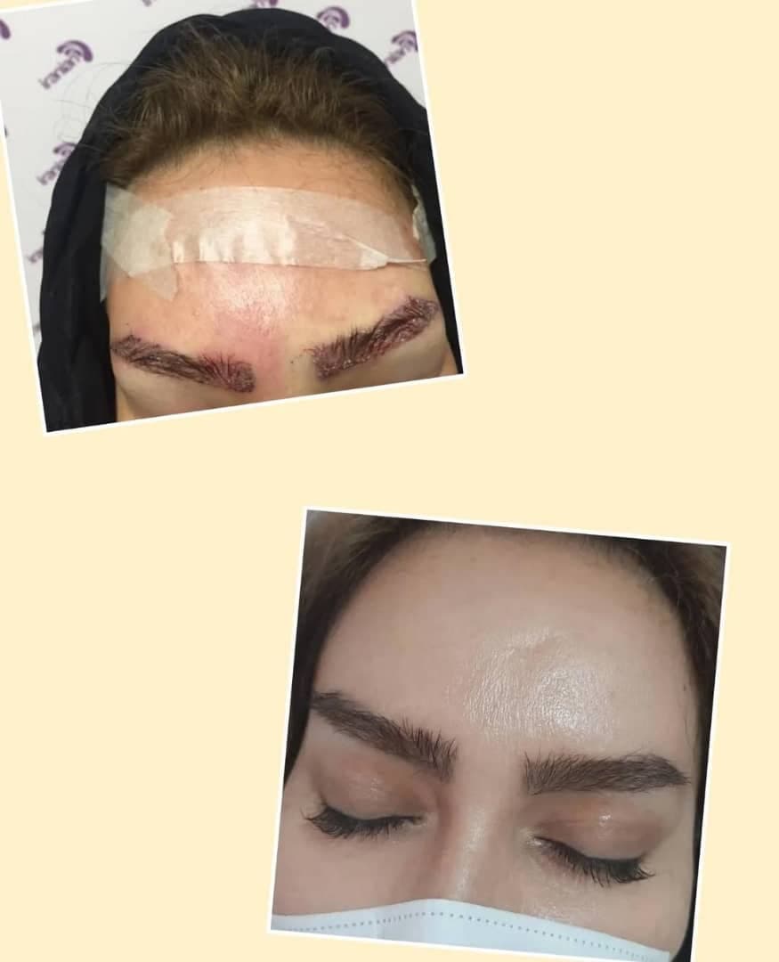 مجموعه کاشت مو و ریش هاتفی در تبریز