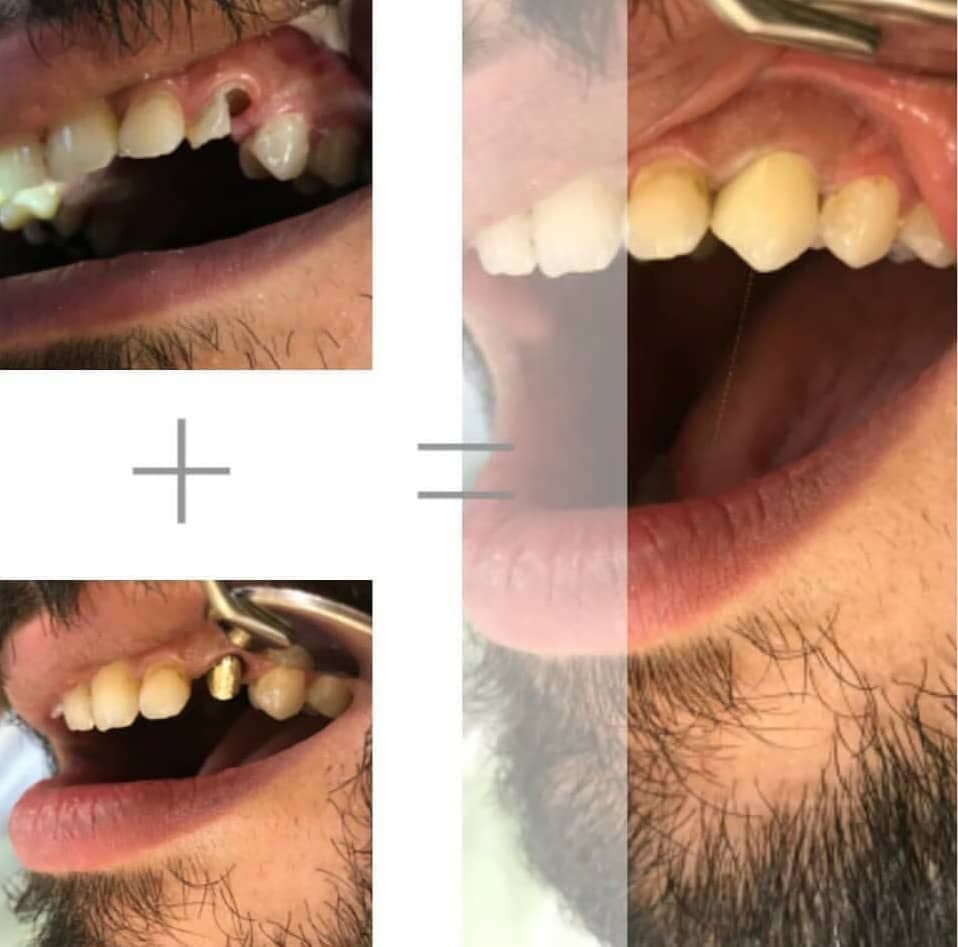 مطب دندانپزشکی دکتر امین خلفی راد در دزفول