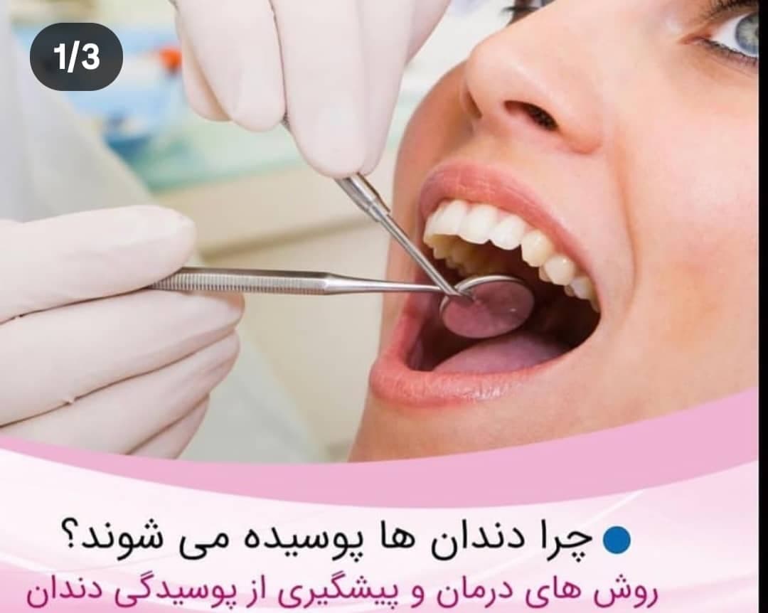 مطب دندانپزشکی دکتر امین خلفی راد در دزفول