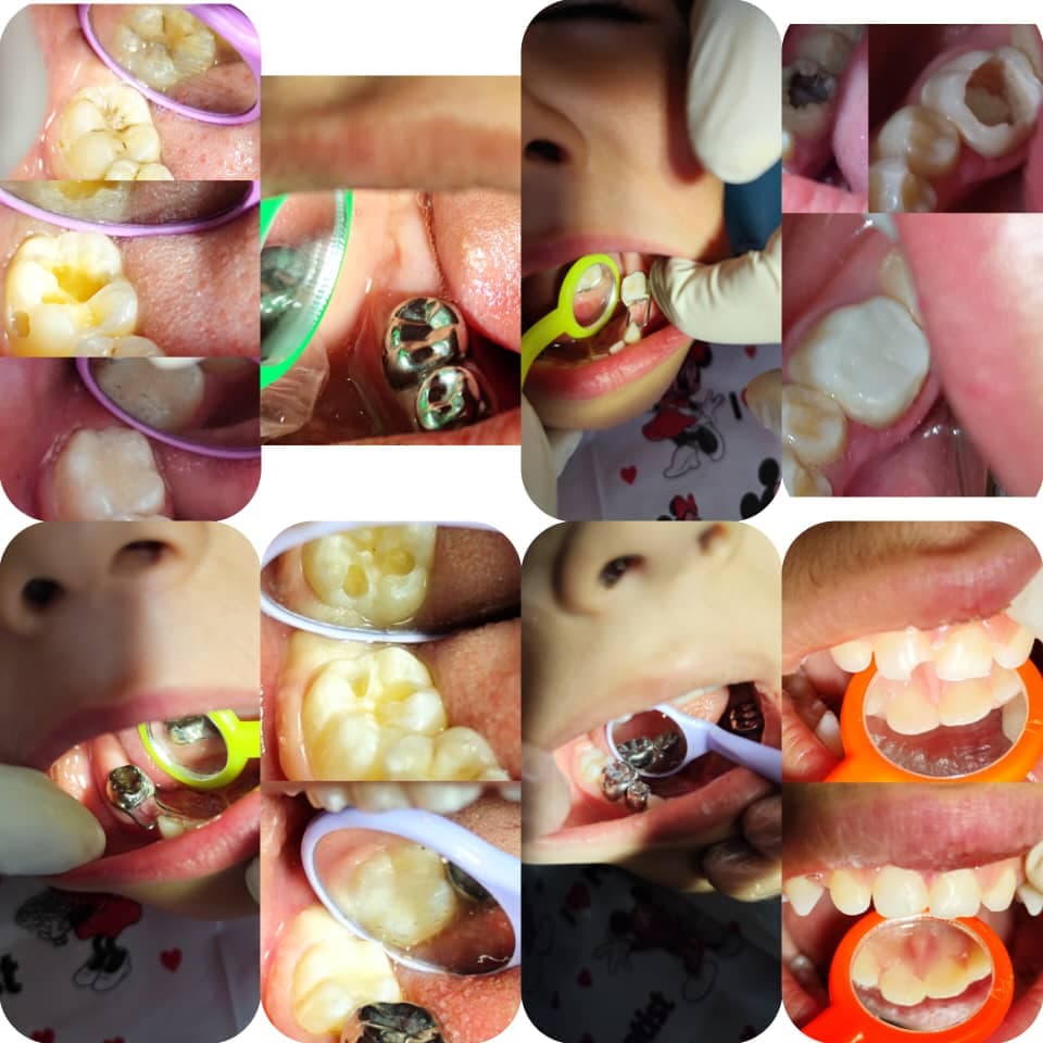 دندانپزشک کودکان دکتر سادات شریفی در شیراز