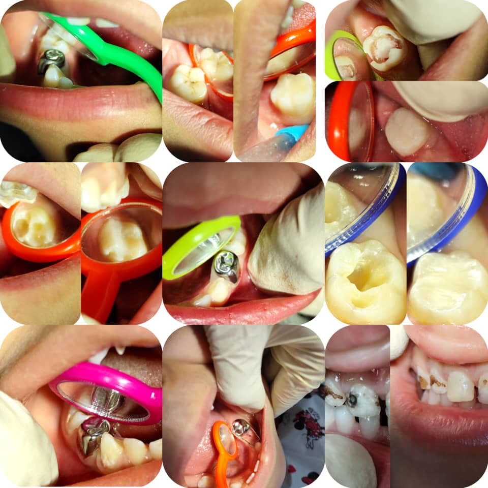 دندانپزشک کودکان دکتر سادات شریفی در شیراز