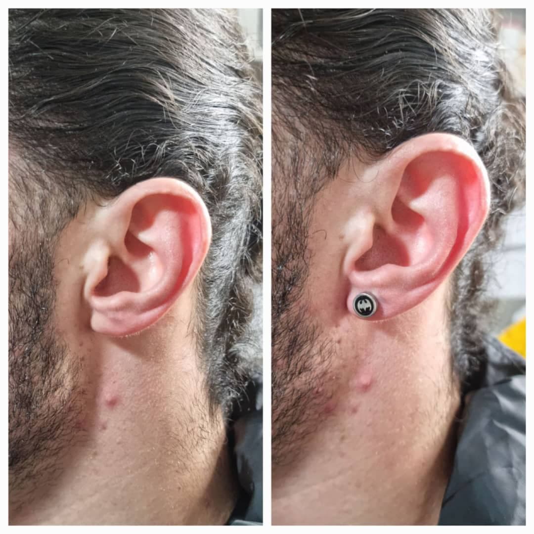 مطب تخصصی رفع ضایعات پوستی و سوراخ کردن گوش دکتر عسکری در سرگل رشت