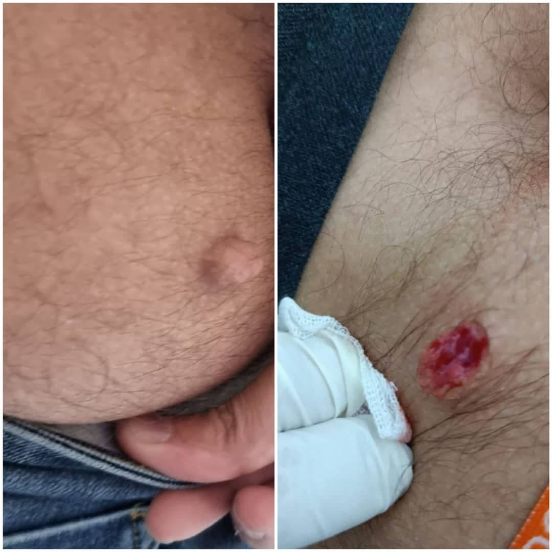 مطب تخصصی رفع ضایعات پوستی و سوراخ کردن گوش دکتر عسکری در سرگل رشت