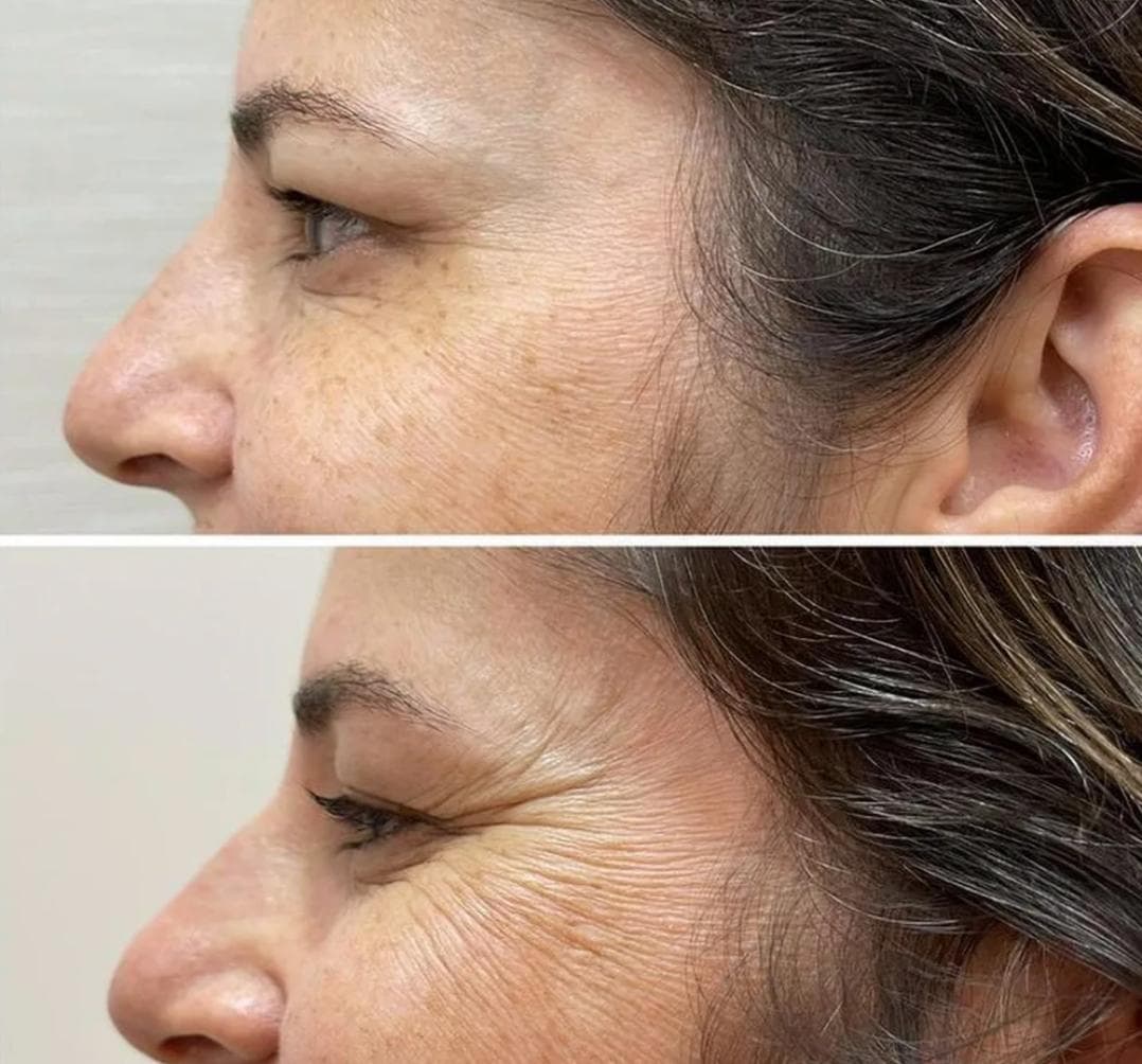 کلینیک تزریق ژل ستی در گرگان
