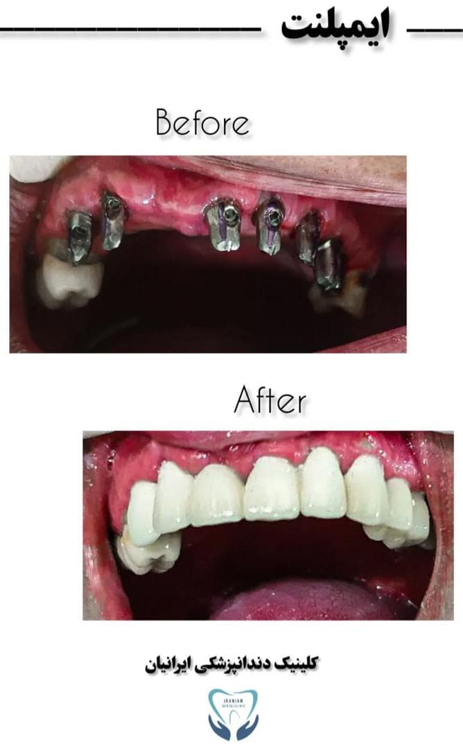 کلینیک دندانپزشکی شبانه روزی ایرانیان در بلوار وکیل آباد مشهد