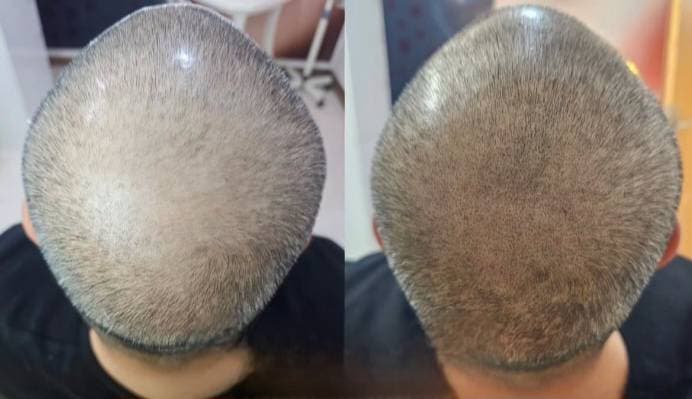 مرکز تخصصی میکروبلیدینگ ابرو سیما توانا در جزیره کیش