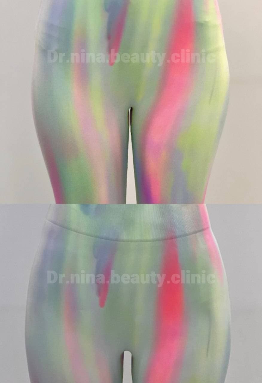 مرکز تخصصی فیلر بادی نینا در قائمشهر