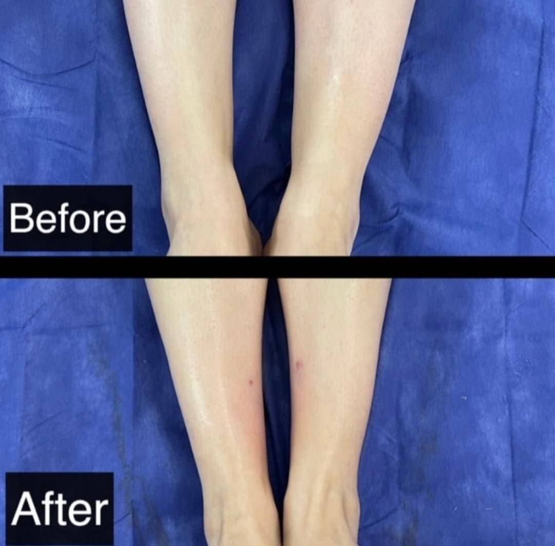 مرکز تخصصی فیلر بادی نینا در قائمشهر