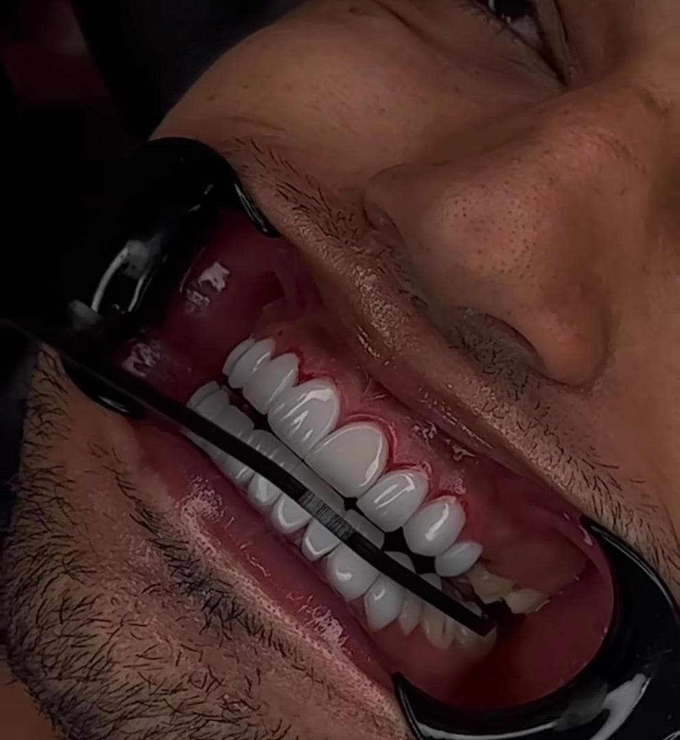 کلینیک دندانپزشکی دکتر راضیه بنی علی در شریعتی تهران