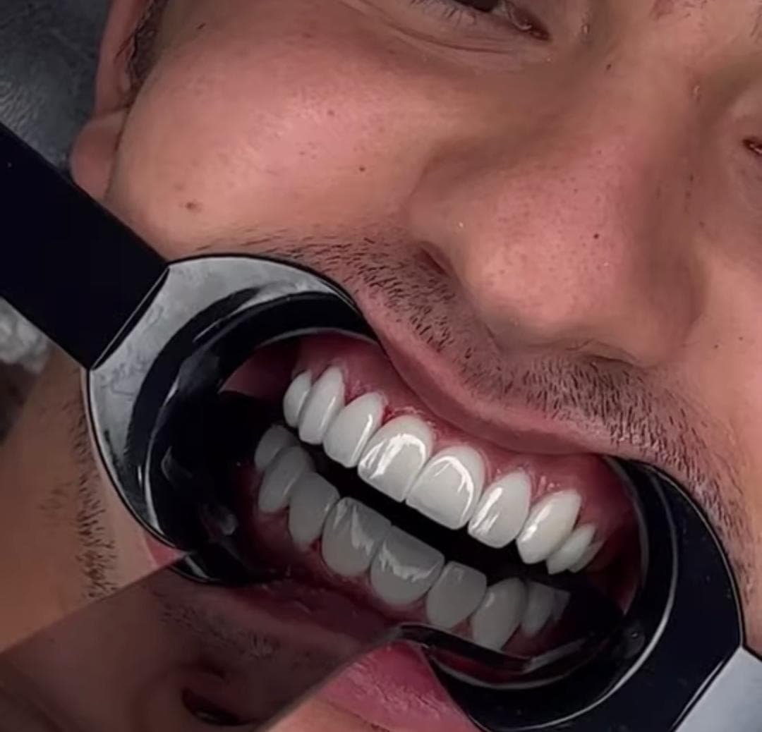 کلینیک دندانپزشکی دکتر راضیه بنی علی در شریعتی تهران