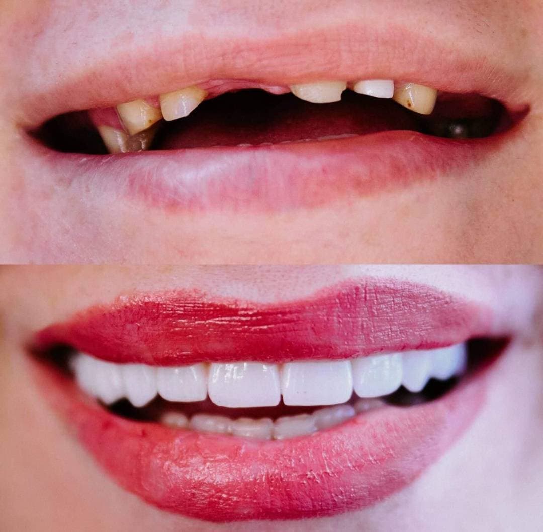 مطب دندانپزشکی دکتر محمود قره باغلو در میاندوآب