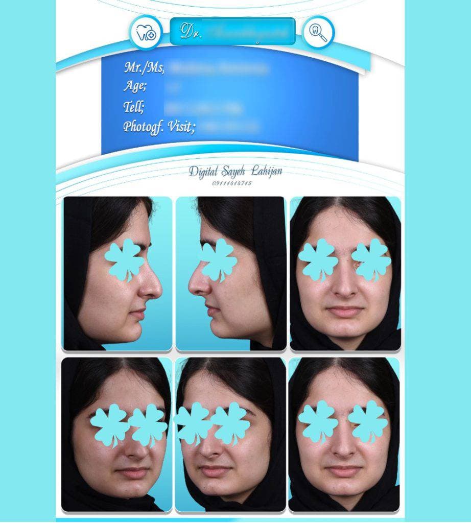 عکاسی پزشکی سایه در لاهیجان