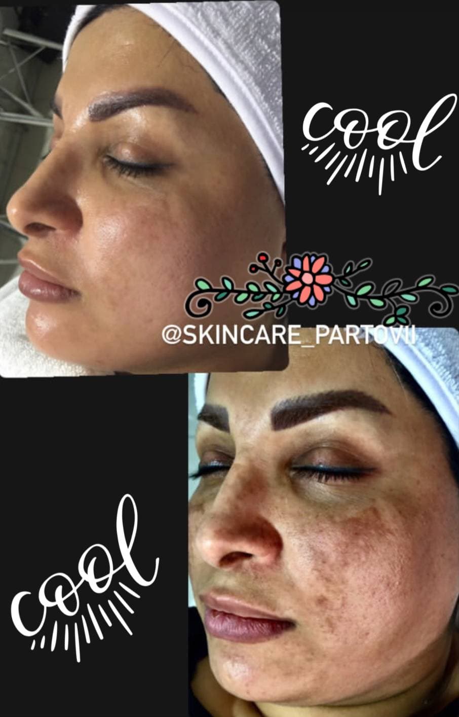 کلینیک تخصصی درمان لک شیرین پرتوی در آمادگاه اصفهان