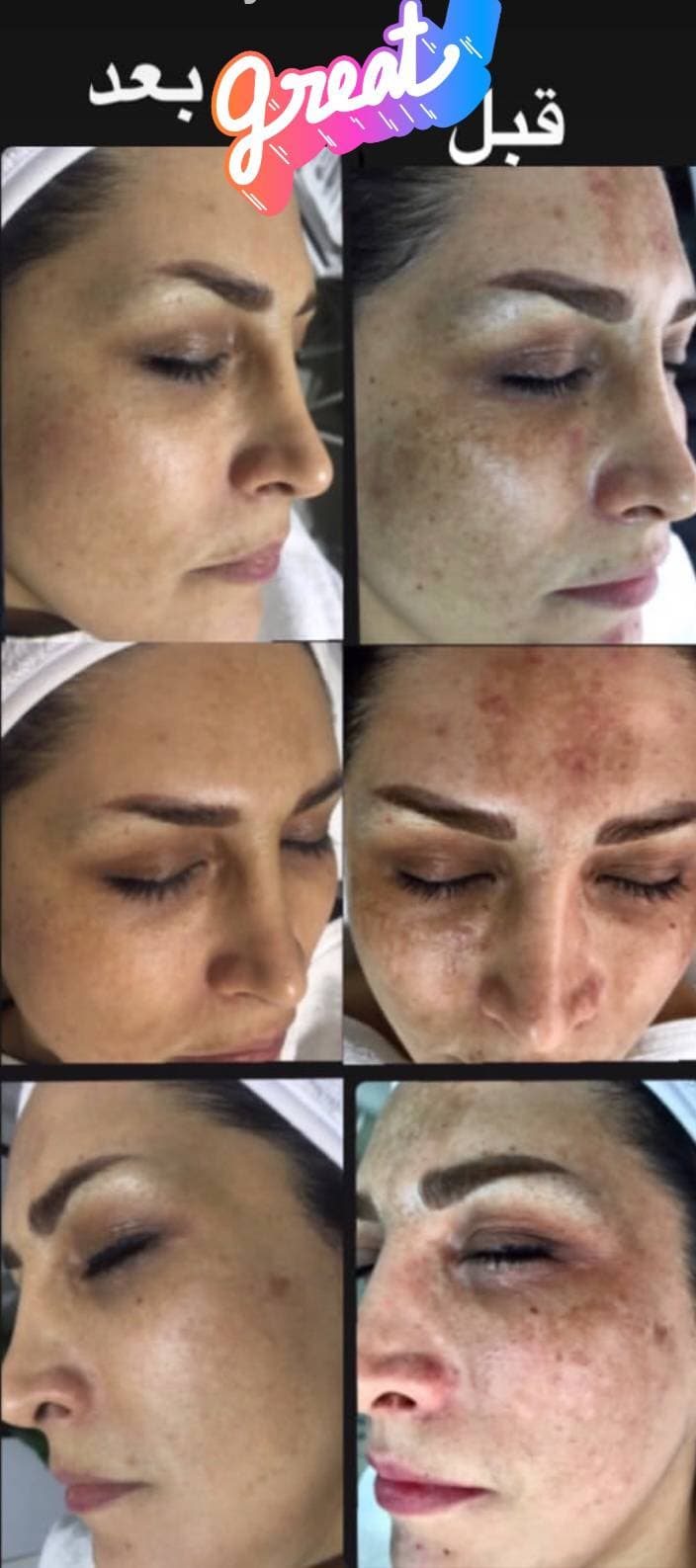 کلینیک تخصصی درمان لک شیرین پرتوی در آمادگاه اصفهان