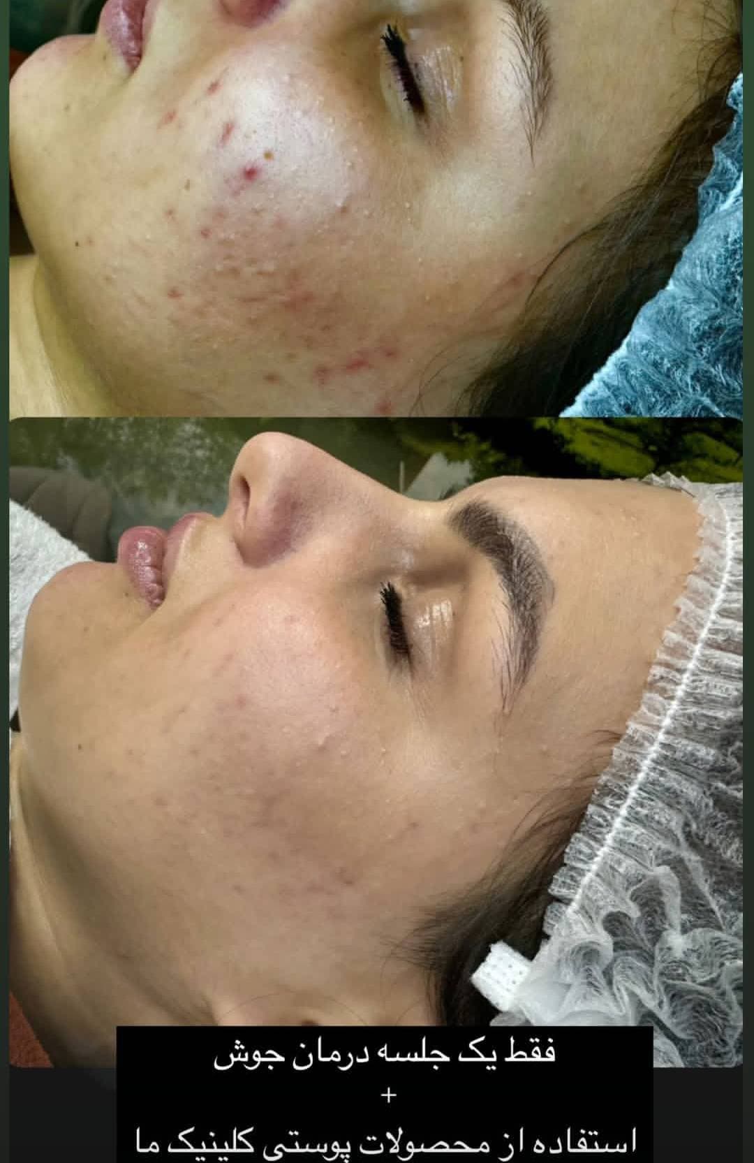 کلینیک تخصصی درمان لک شیرین پرتوی در آمادگاه اصفهان