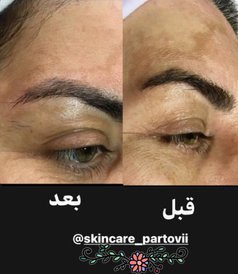 کلینیک تخصصی درمان لک شیرین پرتوی در آمادگاه اصفهان
