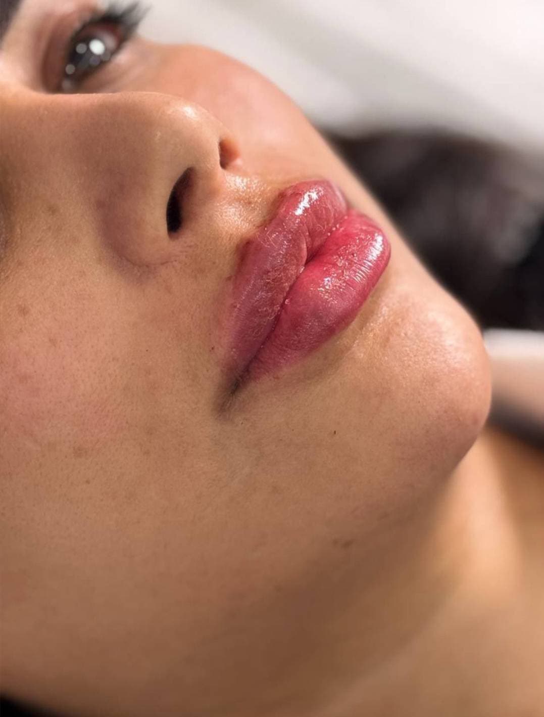 مرکز ویژه فیلر بادی آنیل در بندرعباس