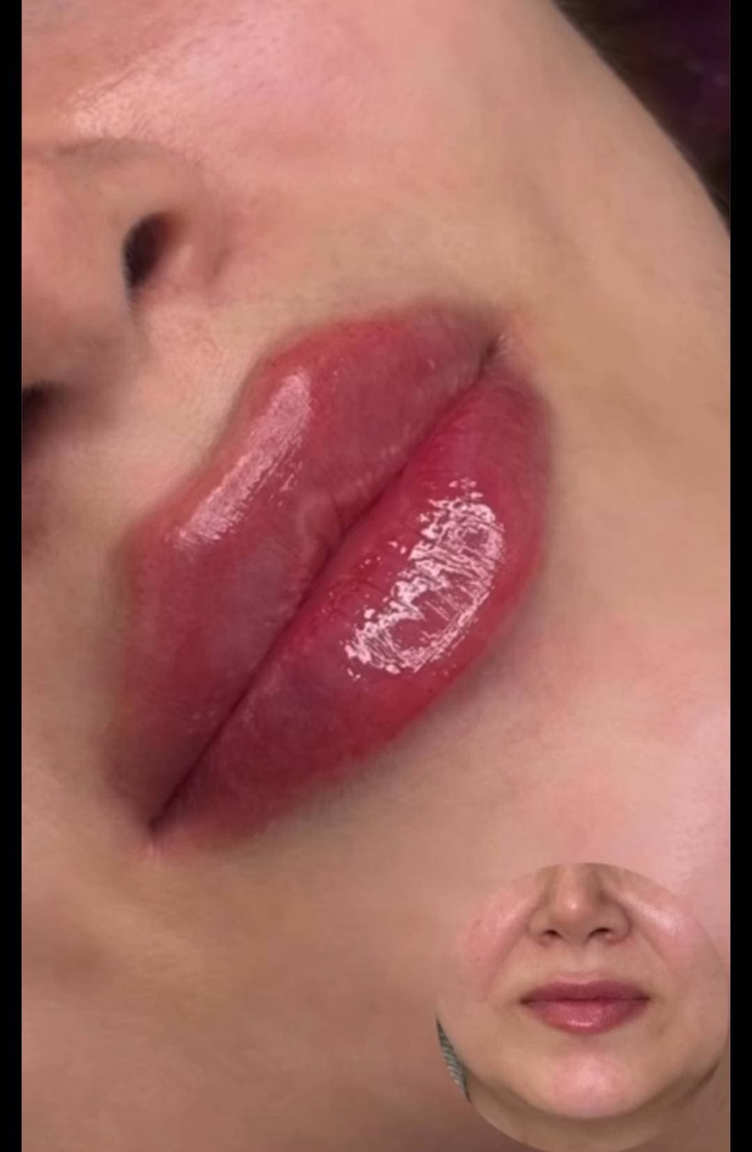 مرکز ویژه فیلر بادی آنیل در بندرعباس