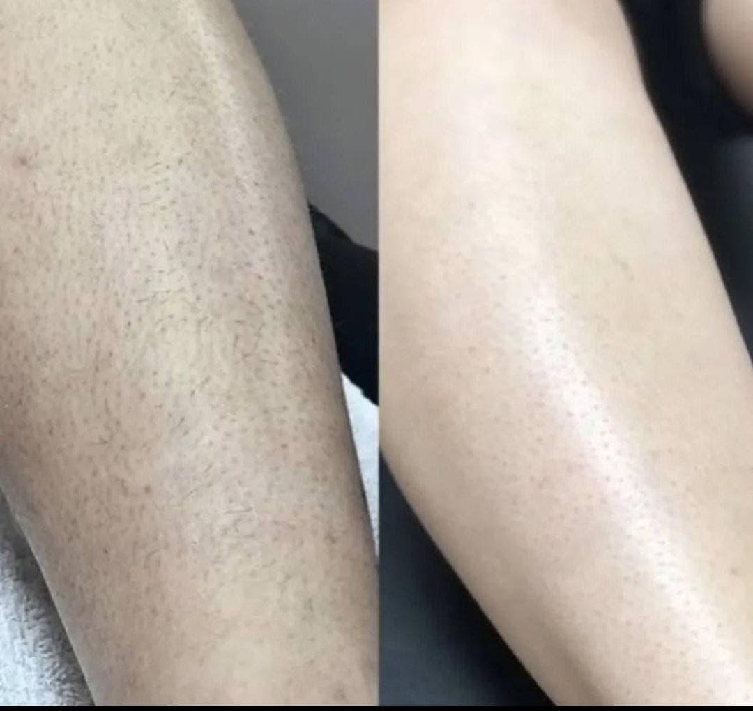 کلینیک لیزر آنیل در بندرعباس