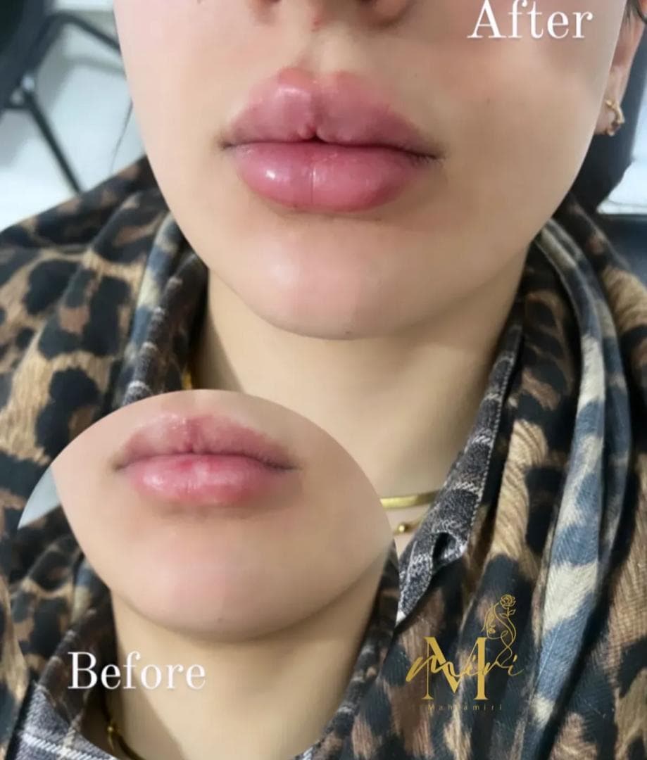 مطب زیبایی پوست و مو دکتر مهلا میری در فاز 2 سهند