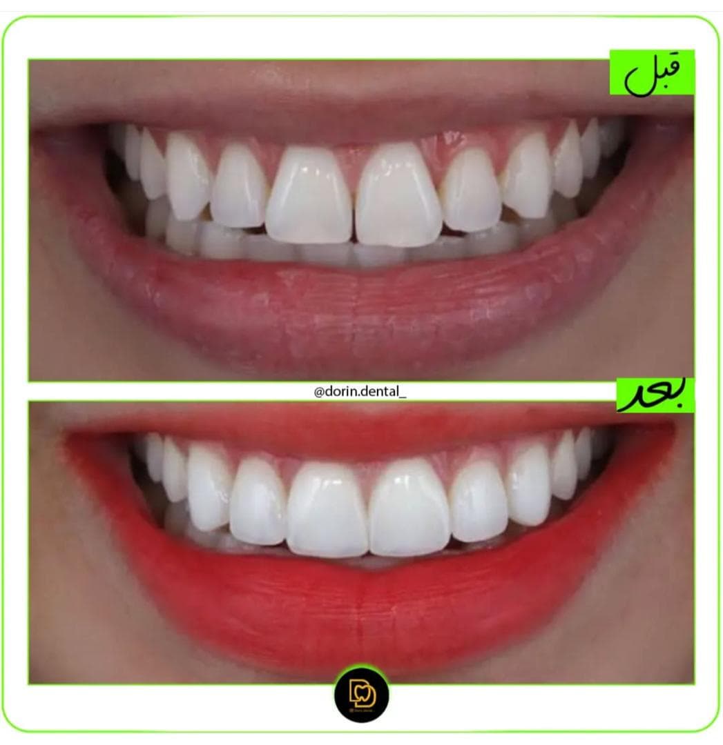 مطب دندانپزشکی درین Dorin در نارمک تهران