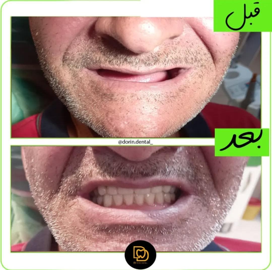 مطب دندانپزشکی درین Dorin در نارمک تهران