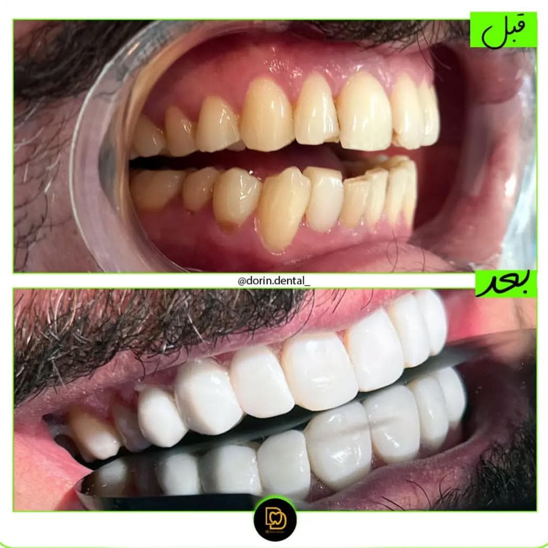 مطب دندانپزشکی درین Dorin در نارمک تهران