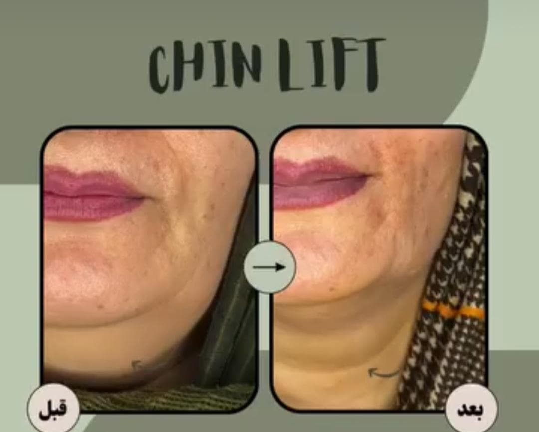 مطب زیبایی دکتر ندا فتاحیان در فردوسی شهرکرد