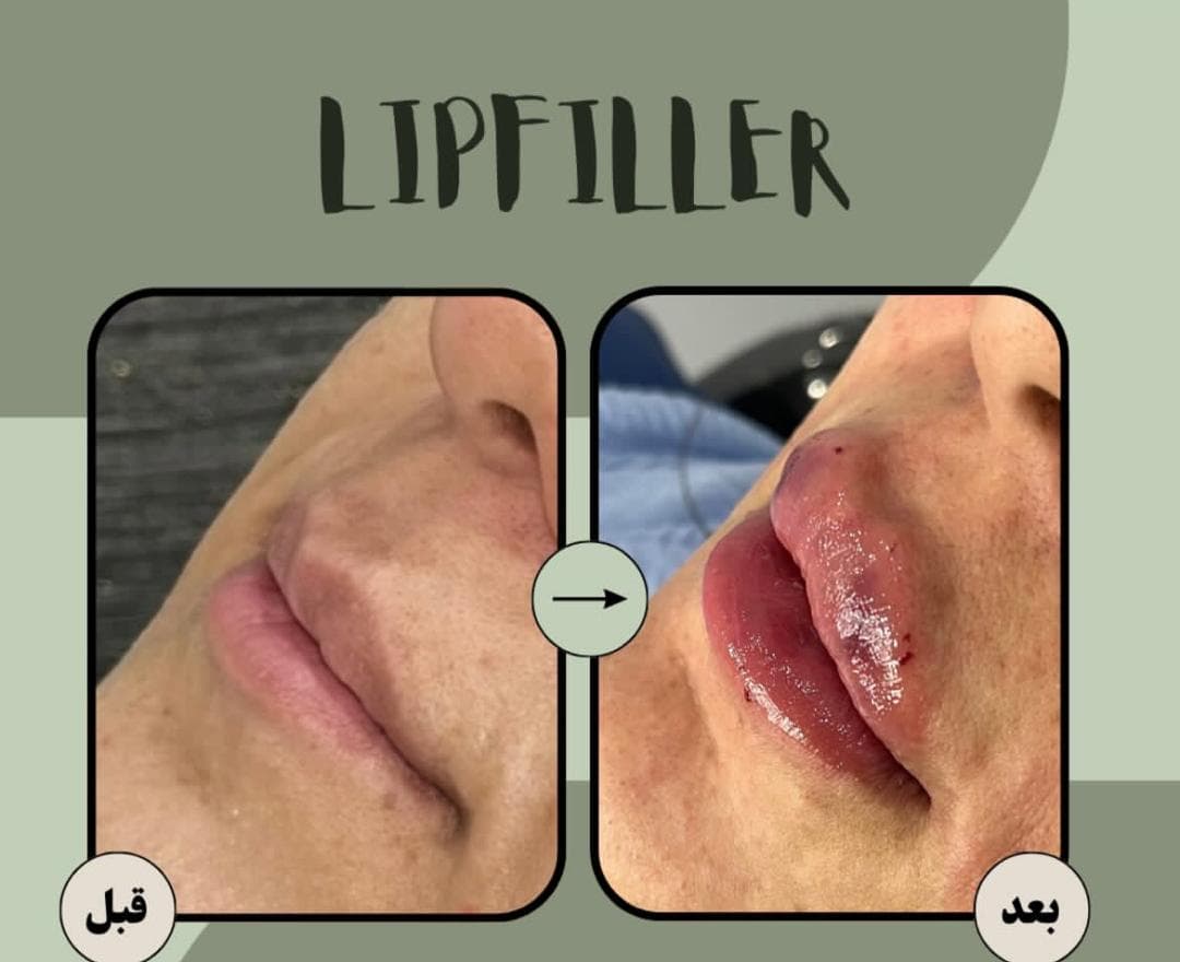 مطب زیبایی دکتر ندا فتاحیان در فردوسی شهرکرد