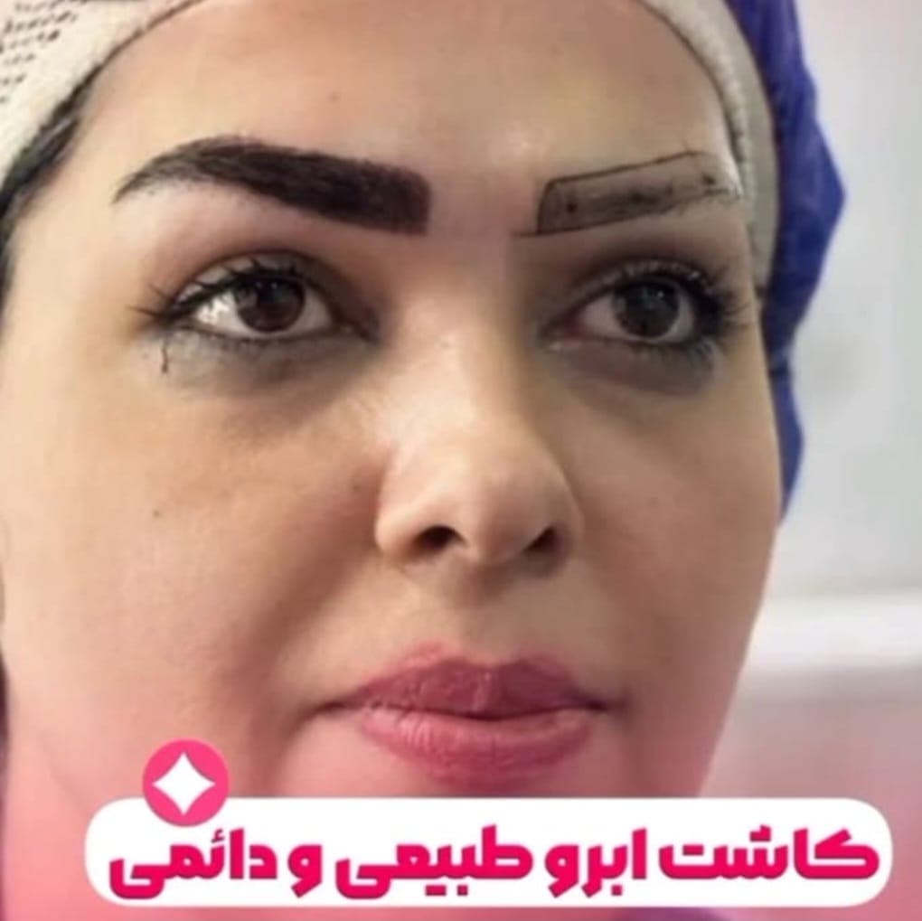 آموزش کاشت ابرو مهتا نجمی تبریز