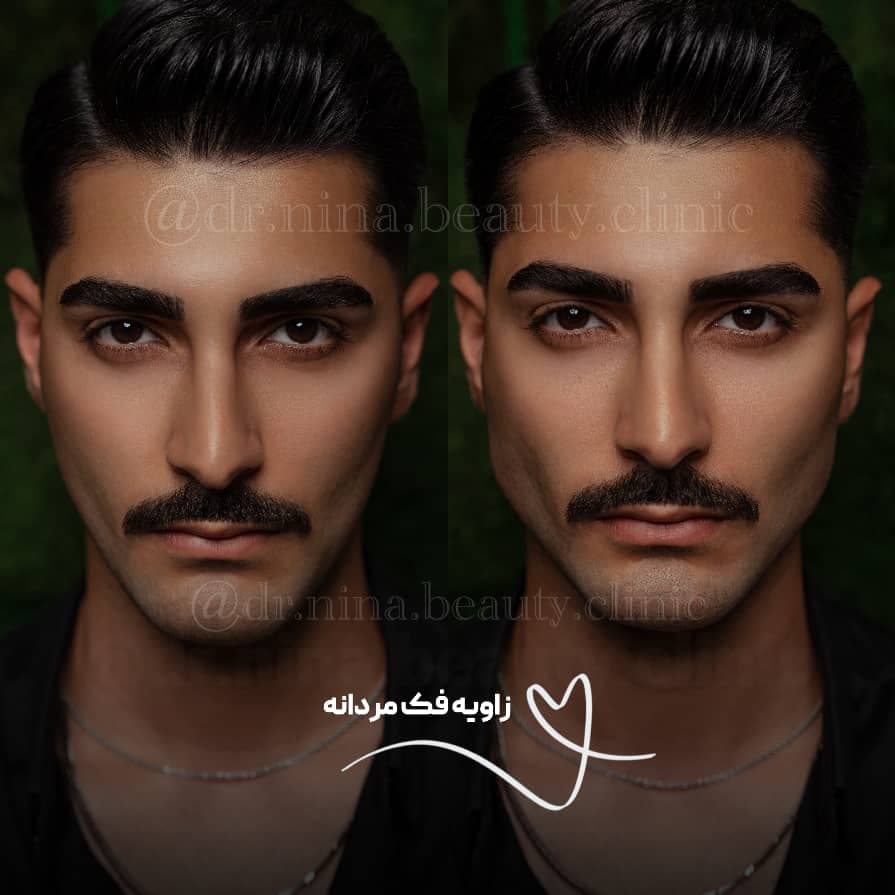 کلینیک زیبایی نینا در قائم شهر