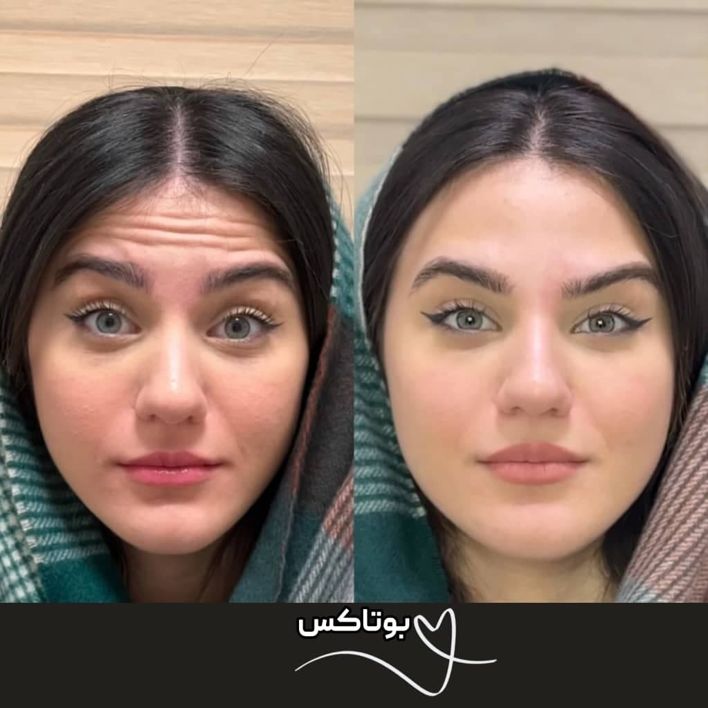 کلینیک زیبایی نینا در قائم شهر