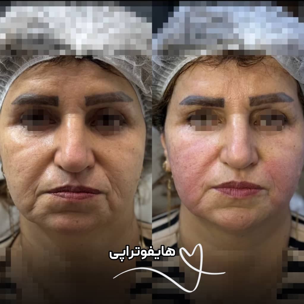 کلینیک زیبایی نینا در قائم شهر