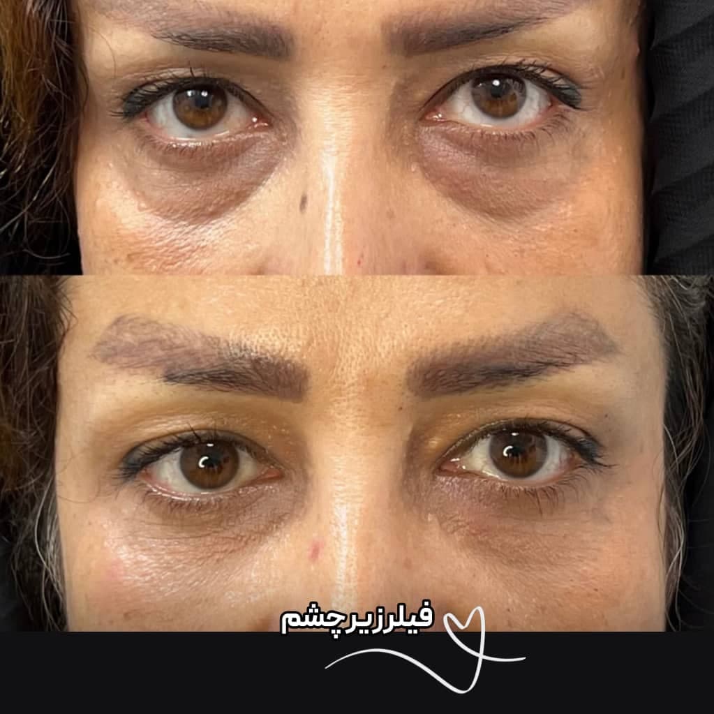 کلینیک زیبایی نینا در قائم شهر