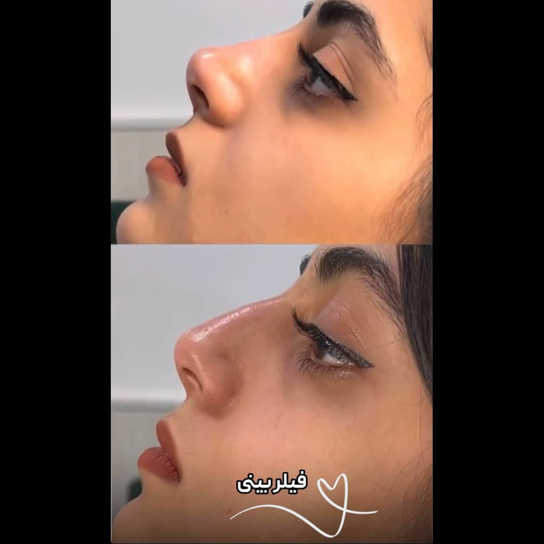 کلینیک زیبایی نینا در قائم شهر