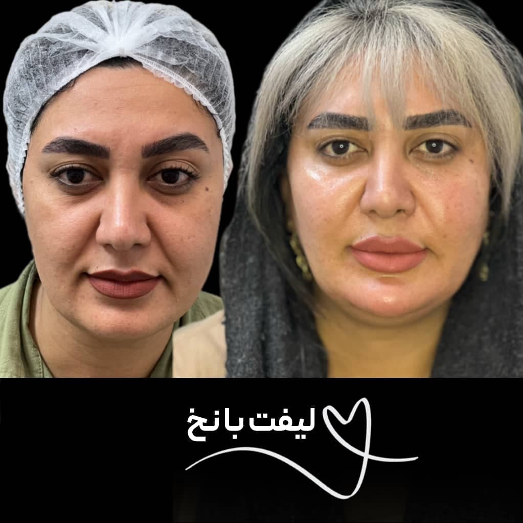 کلینیک زیبایی نینا در قائم شهر