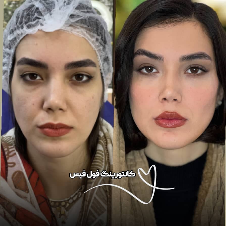 کلینیک زیبایی نینا در قائم شهر