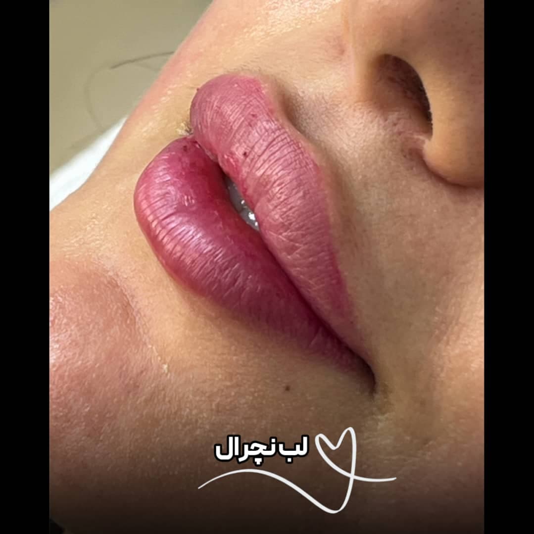 کلینیک زیبایی نینا در قائم شهر