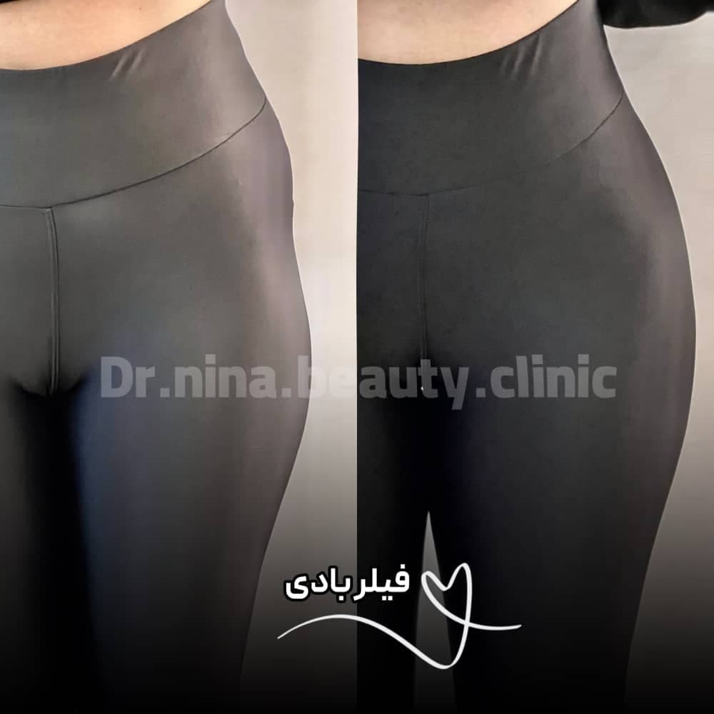 کلینیک زیبایی نینا در قائم شهر