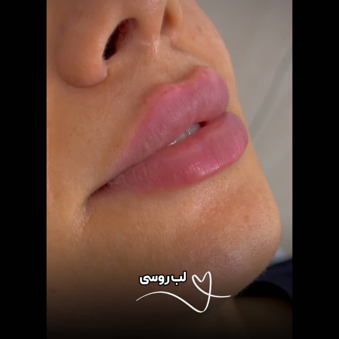 کلینیک زیبایی نینا در قائم شهر