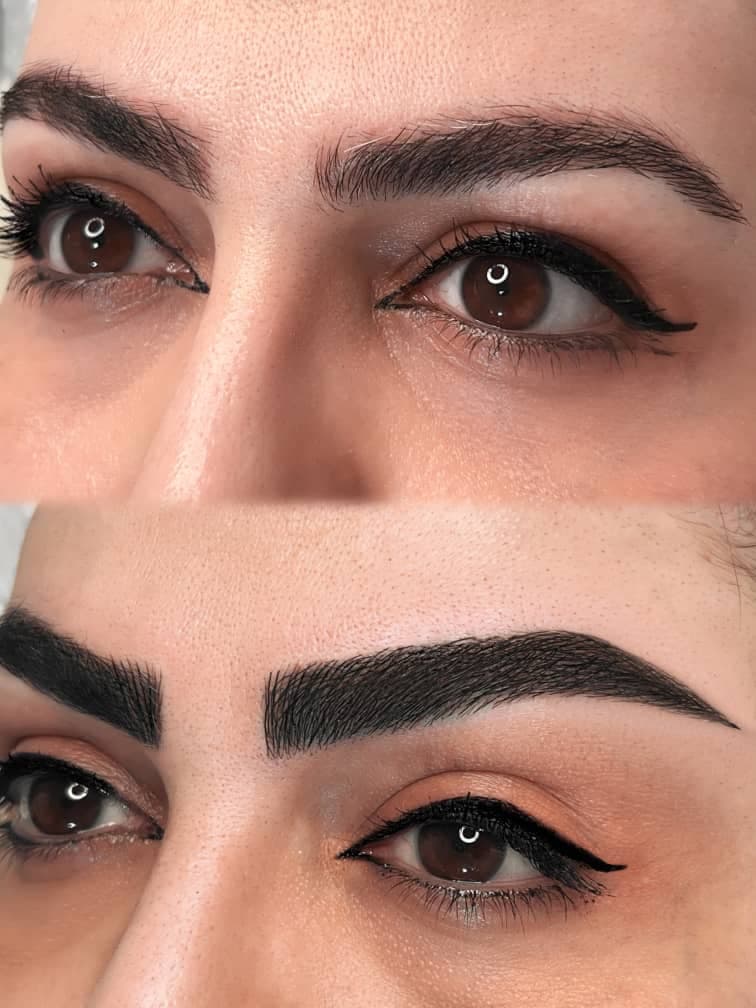 مرکز تخصصی میکروبلیدینگ و میکروپیگمنتیشن رعنا واحدی لاهیجان