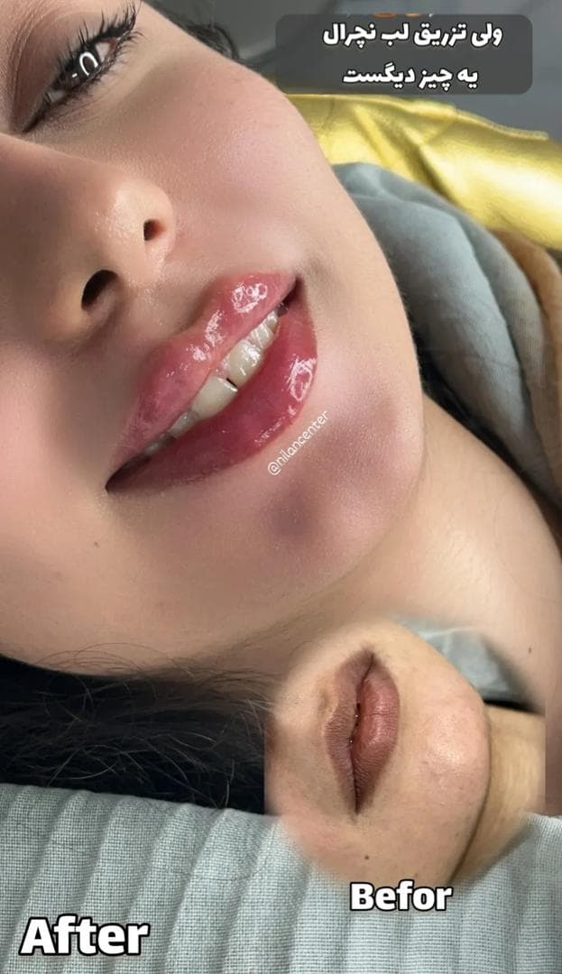 کلینیک زیبایی و پوست و لیزر اکرم آچاک پور در بهبهان خوزستان