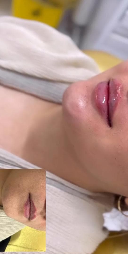 کلینیک زیبایی و پوست و لیزر اکرم آچاک پور در بهبهان خوزستان