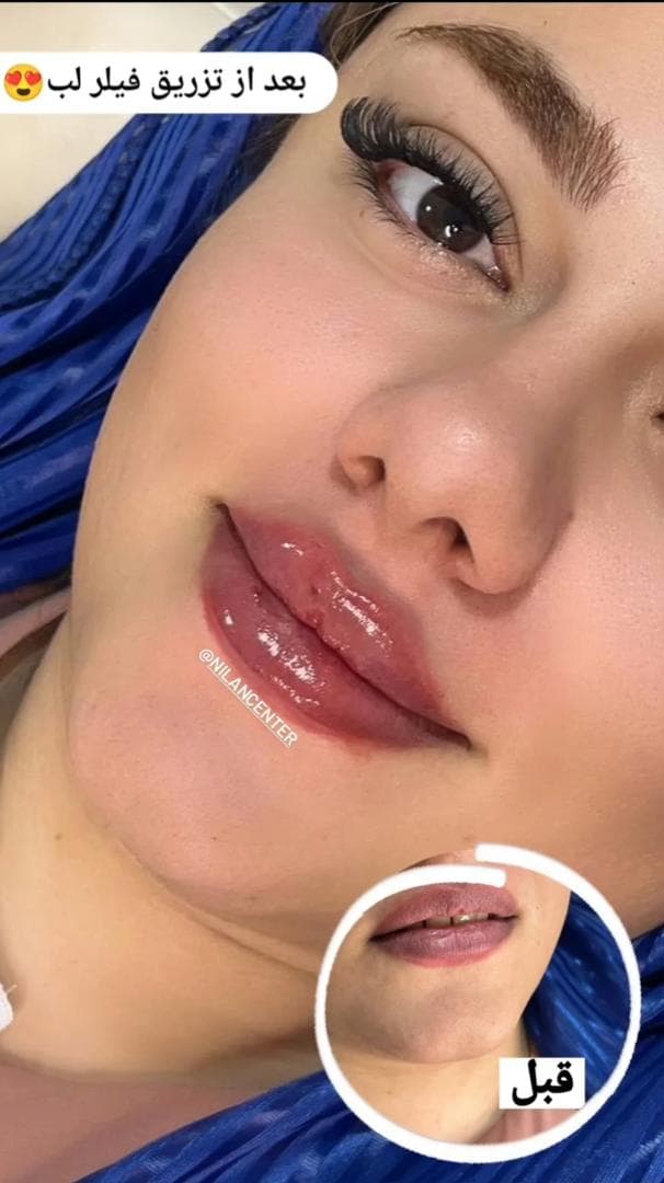 کلینیک زیبایی و پوست و لیزر اکرم آچاک پور در بهبهان خوزستان