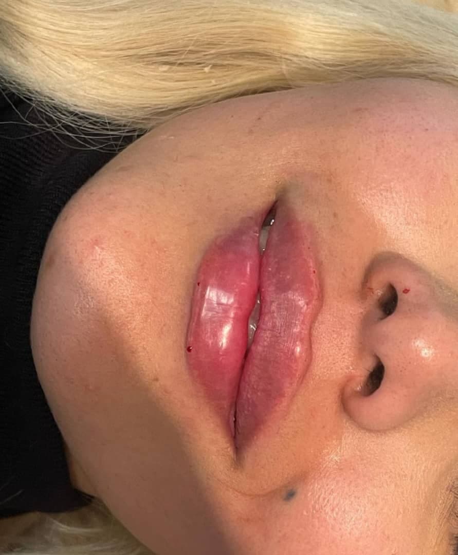 مرکز ویژه فیلر بادی آنیل در بندرعباس