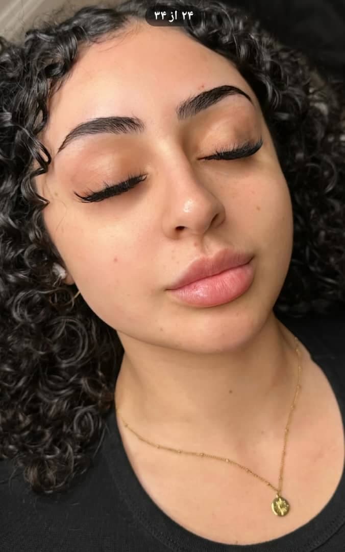 مرکز ویژه فیلر بادی آنیل در بندرعباس