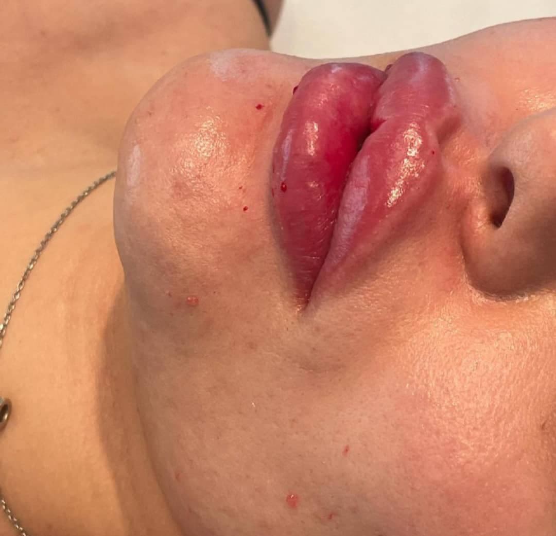 مرکز ویژه فیلر بادی آنیل در بندرعباس