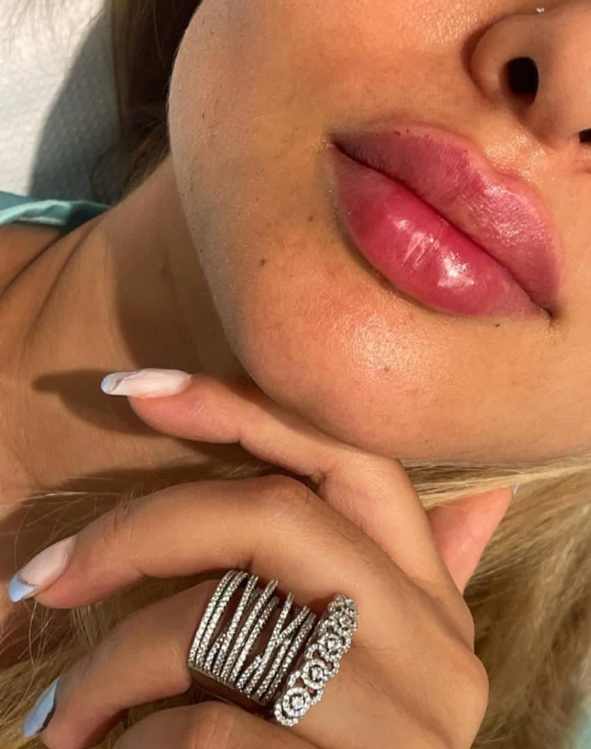 مرکز ویژه فیلر بادی آنیل در بندرعباس