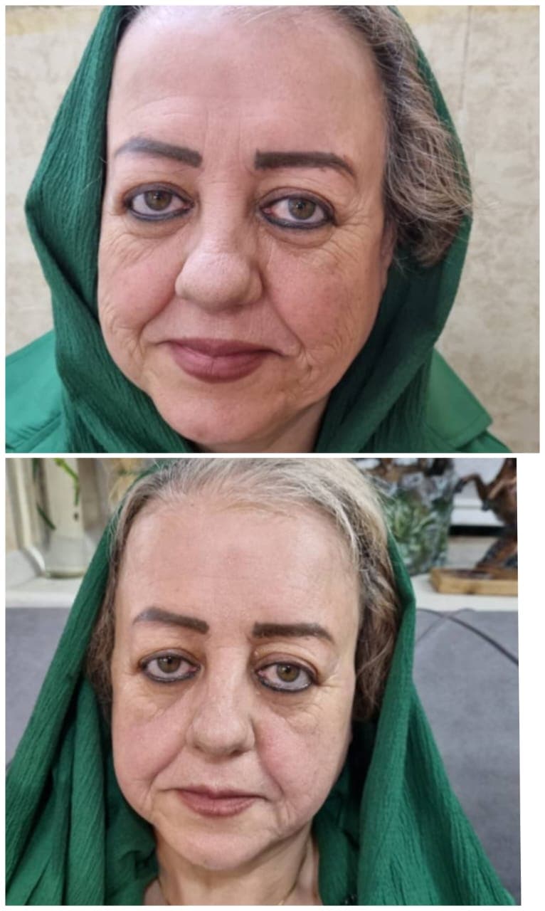 مطب پوست و مو دکتر حبیب الهی در اصفهان